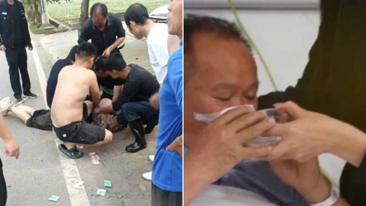 Kadini kurtarmak isterken dehseti yasadi saldirgan burnunu koparip yuttu pEPM1qFf